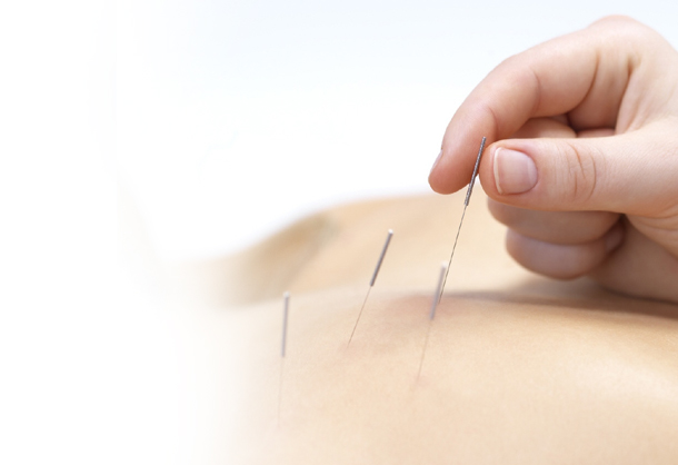 ACUPUNTURA2